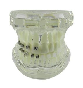 LD Ortho Model with 4 Kinds of Brackets - LD-088