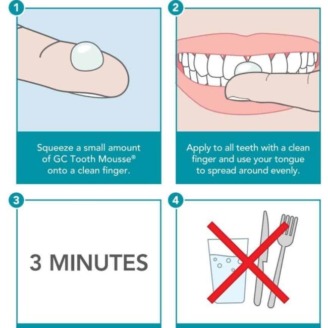 how-to-use-gc-tooth-mousse.jpg how-to-use-gc-tooth-mousse.jpg
